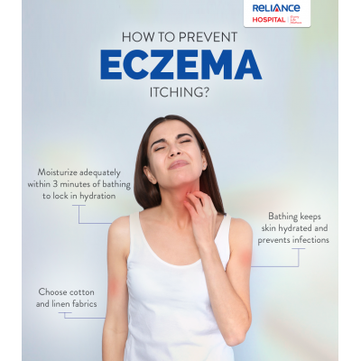 Prevent Eczema