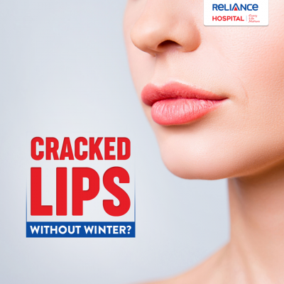 Cracked Lips?