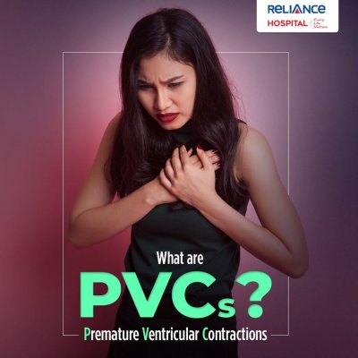 What are PVC's?
