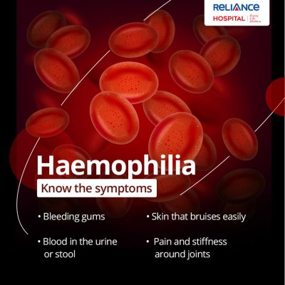 Know the symptoms of Haemophilia