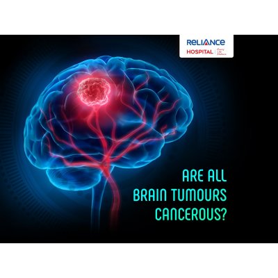 Are all brain tumours cancerous?