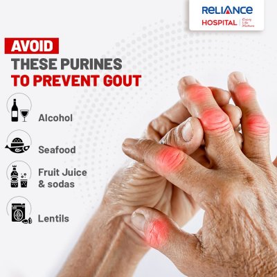 Avoid these purines to prevent gout