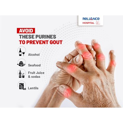 Avoid these purines to prevent gout