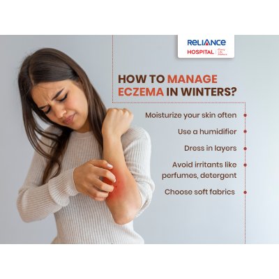 How to manage eczema in winters?