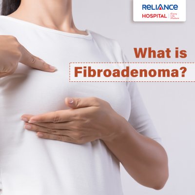 What is Fibroadenomas?