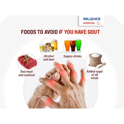 Foods to avoid if you have gout 