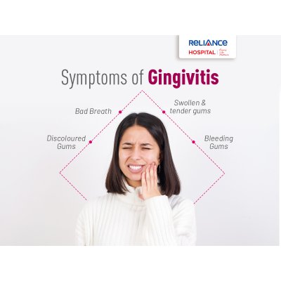 Symptoms of Gingivitis