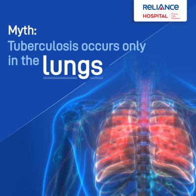 Myth: Tuberculosis occurs only in the lungs