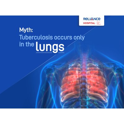 Myth: Tuberculosis occurs only in the lungs