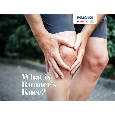 What is runner's knee?