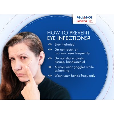How to prevent eye infections?