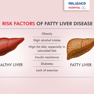 Risk factors of fatty liver disease
