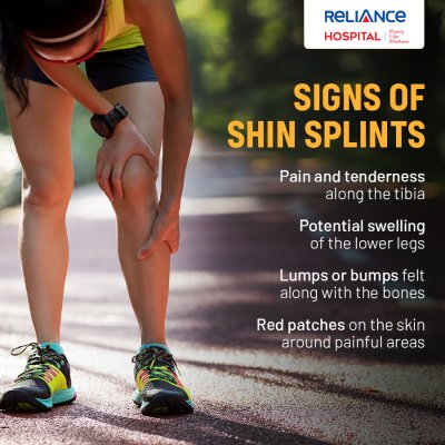 Signs of shin splints