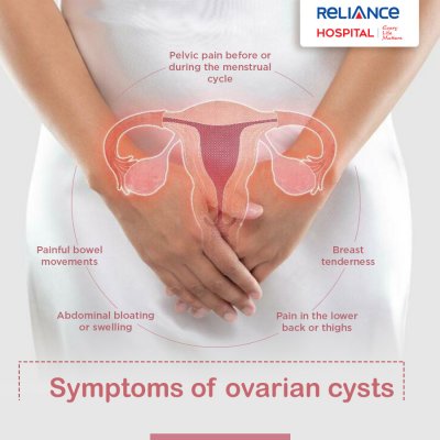 Symptoms of ovarian cysts 