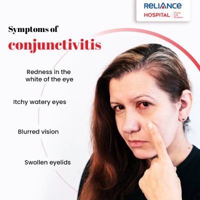 Symptoms of conjunctivitis 