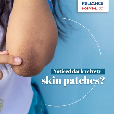 Noticed dark velvety skin patches?
